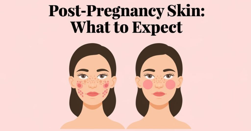 Post-Pregnancy Skin: What to Expect