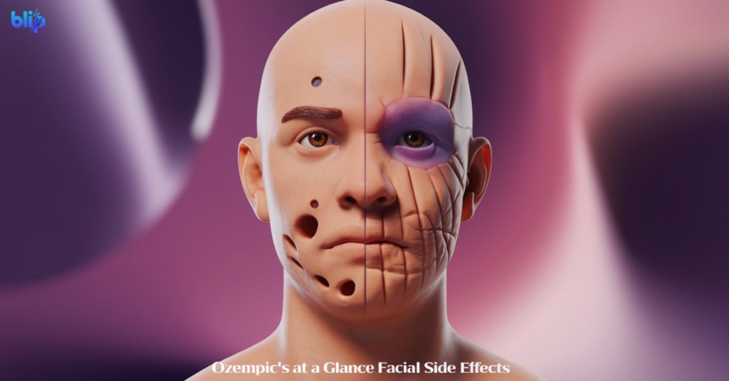 Ozempic's At a Glance Facial Side Effects