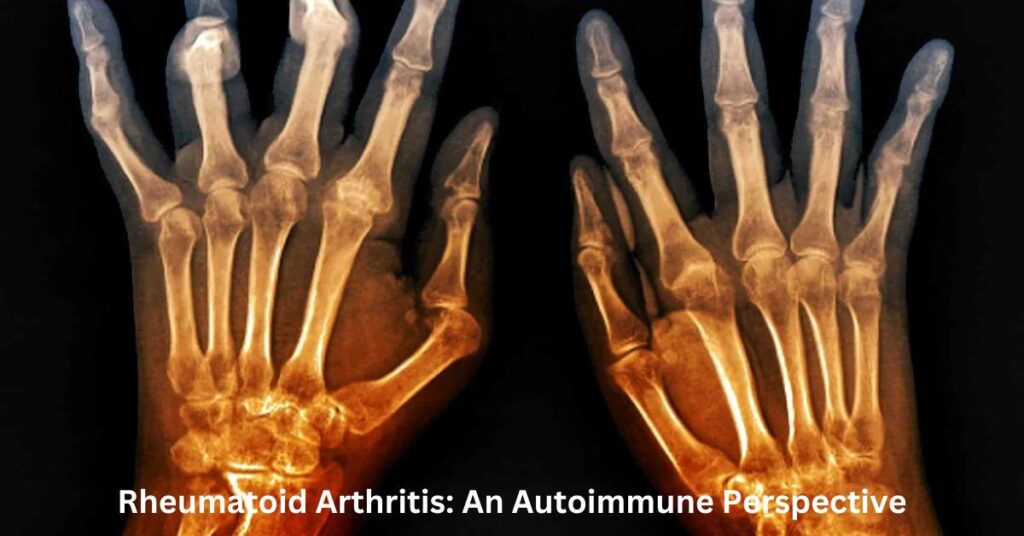 Rheumatoid Arthritis: An Autoimmune Perspective