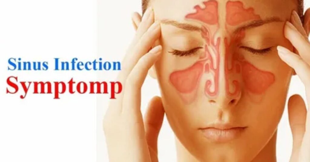 Sinus Infection Symptoms