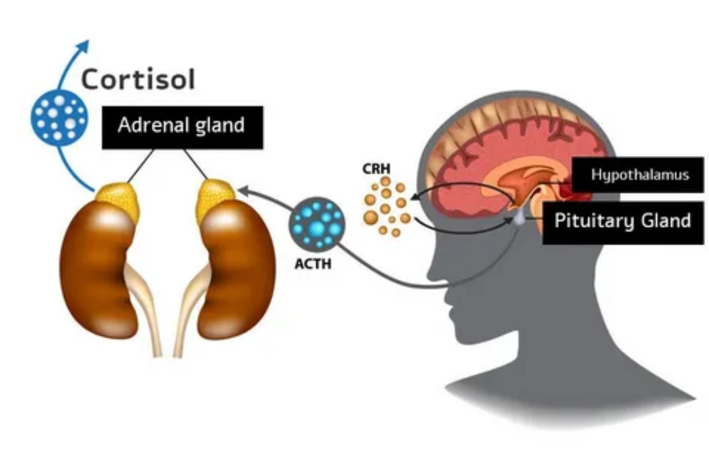 High Cortisol Levels: Causes, Effects, and Management