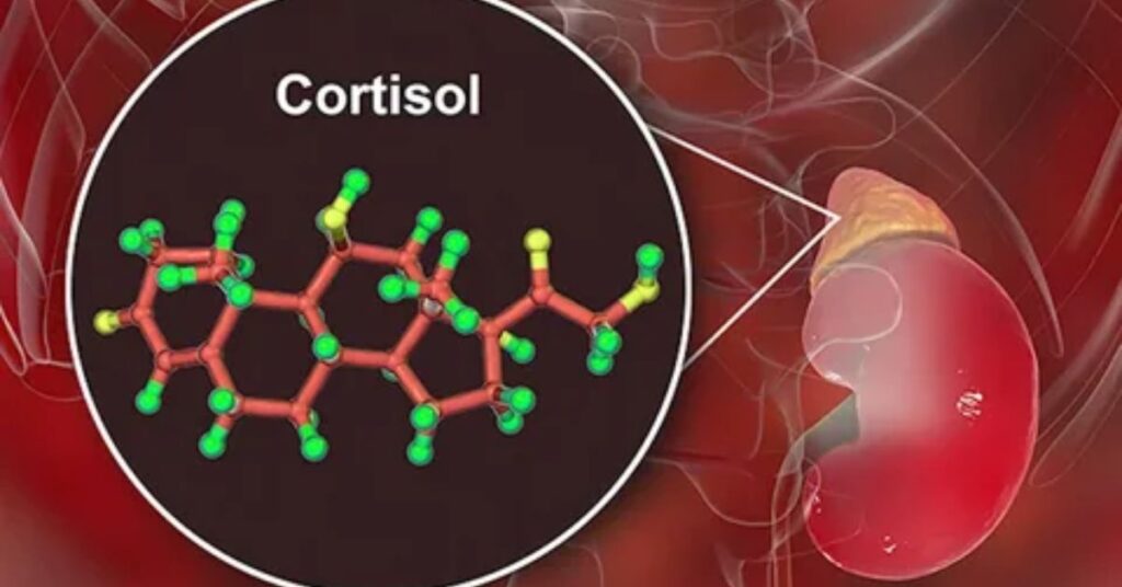 Impact of High Cortisol Levels on Health