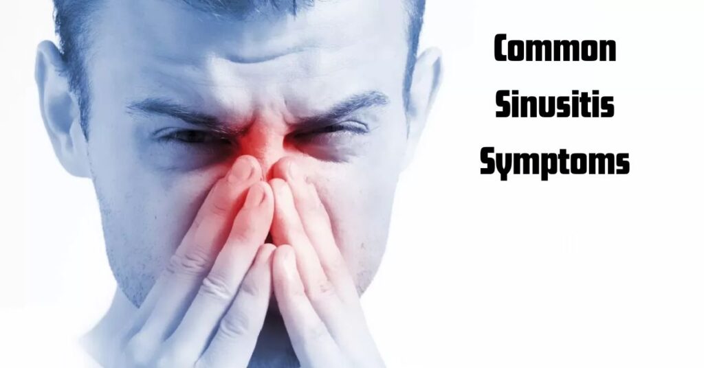 Common Sinusitis Symptoms