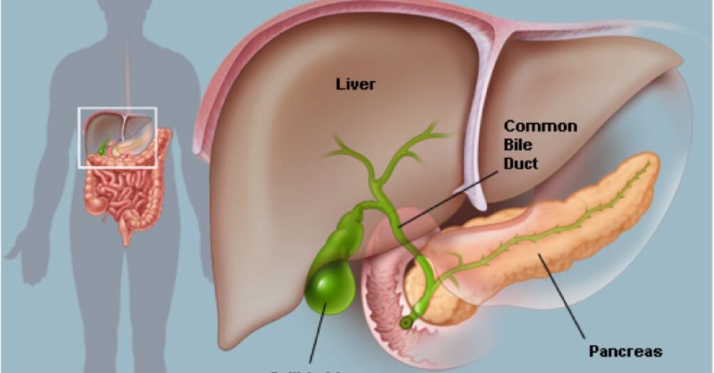 Common Types of Gallbladder Problems